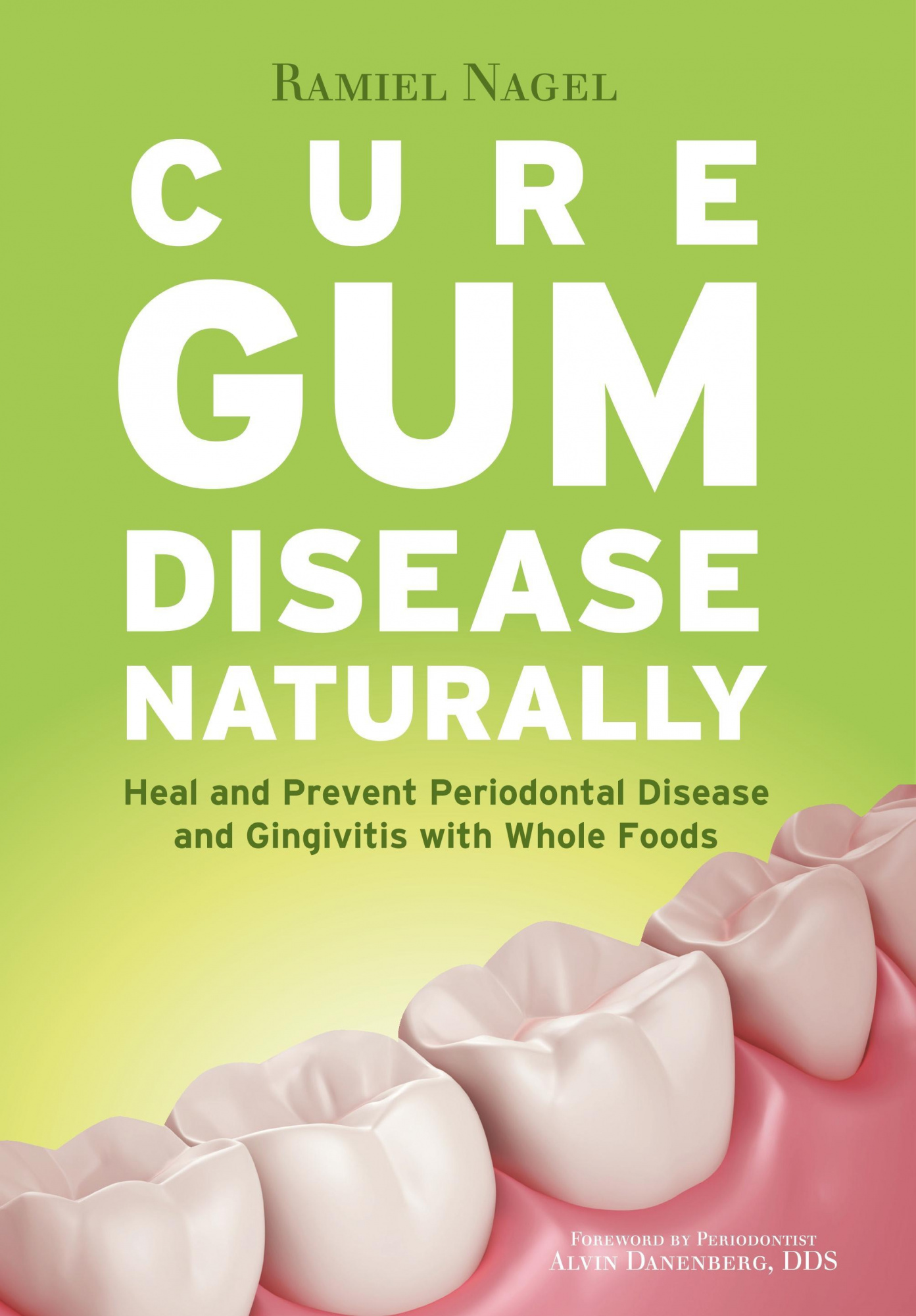Cure Gum Disease Naturally: Heal Gingivitis and Periodontal Disease with Whole Foods