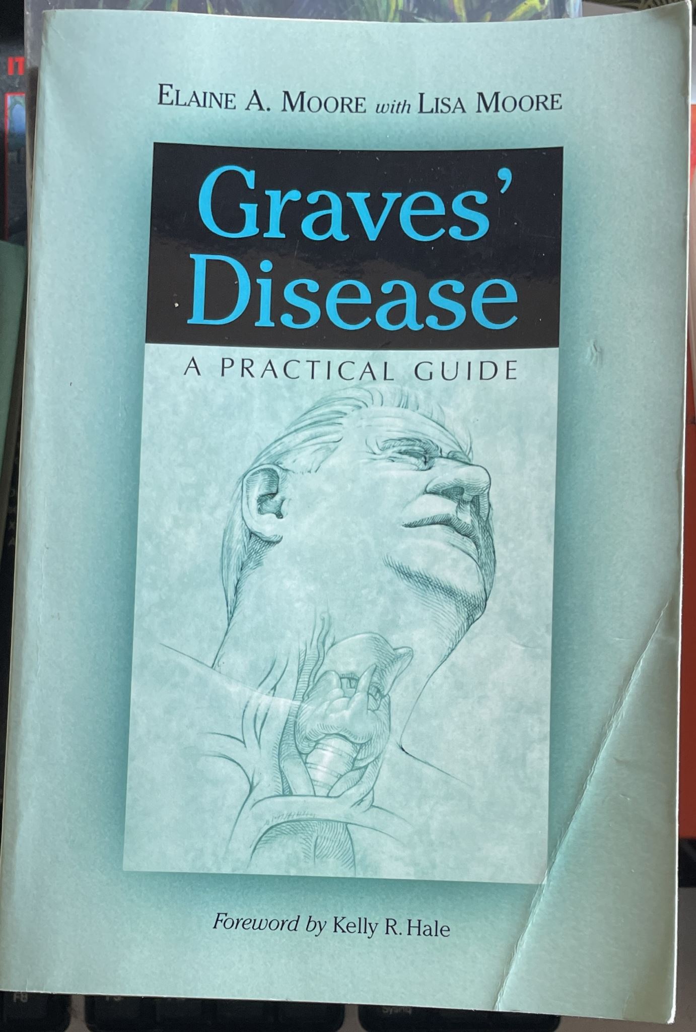 Graves' Disease A Practical Guide By Elaine A. Moore, Lisa Moore